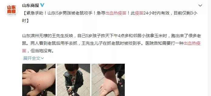 被老鼠咬后，出血热疫苗该不该打