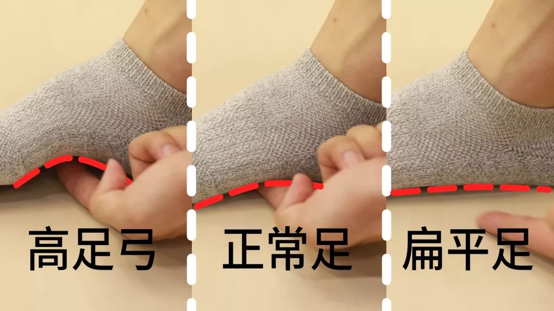 走路袜子往下掉怎么办,走路掉鞋妙招