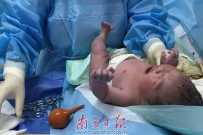 广东深圳试管3万补贴政策,广东有多少家儿童康复医院