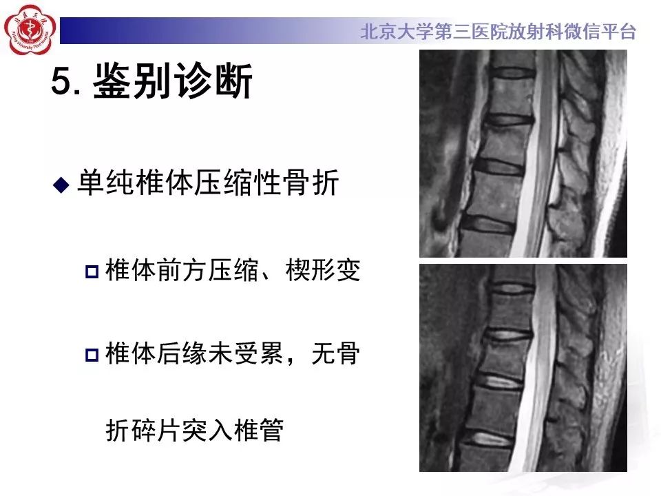 「每日一例｜893例」女，49岁，摔伤致腰部疼痛，活动受限1天