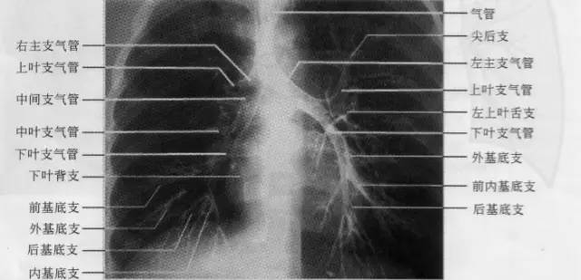 胸部ct解剖结构,胸部x线解读视频