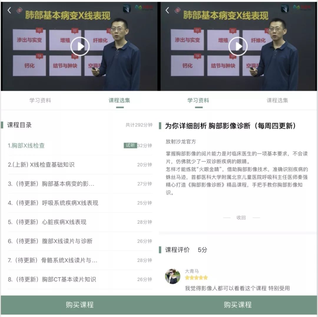 椎间盘膨出、突出、脱出如何鉴别，几幅图让你一目了然