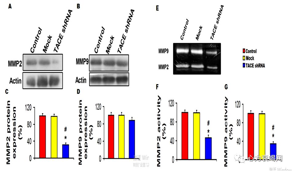 「2019CIHFC」张运教授:ADAM17—糖尿病性心肌病干预的新靶点