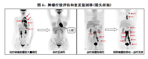 检查癌症最先进的仪器,目前最先进的查癌症的设备是