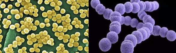 长脓疱、流黄水…最近这种病高发，不少孩子已中招！注意了