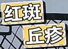 脸颊色斑越来越多,色斑越长越多