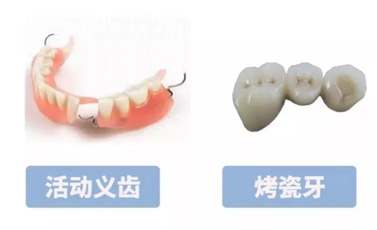爱牙日活动优惠,2023爱牙日活动