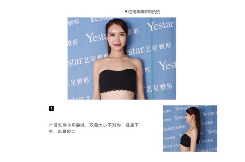 全能美女的美胸蜕变用实力碾压“平胸更时尚”的柠檬精