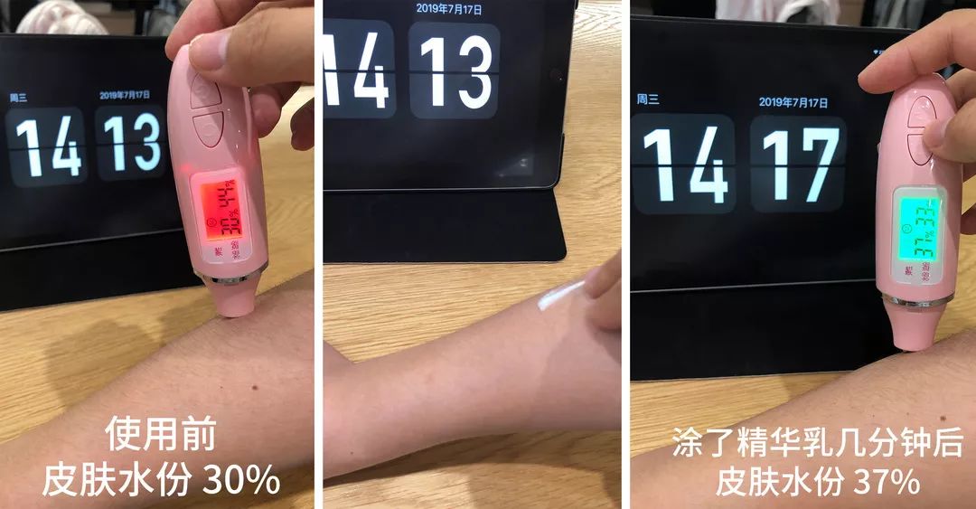 冬天皮肤起皮干燥有碎屑怎么保湿,下巴周围干燥起皮有小疙瘩