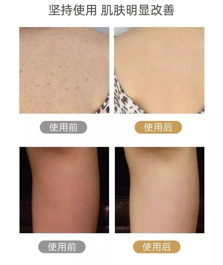 搓背沐浴刷双面,无死角搓背洗澡刷