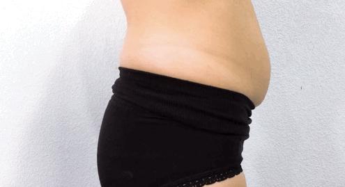 告别“大腹婆”，立变“小腰精”！穿上它，躺着拥有平坦小腹