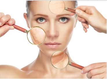 脸上长了脂肪粒用什么方法能去除,脸上长脂肪粒3个小妙招去除