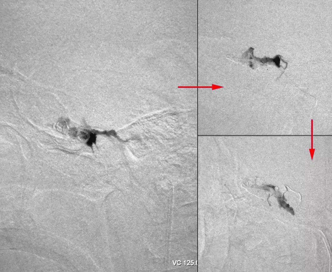 柳暗花明第二集,柳暗花明52集完整版下载