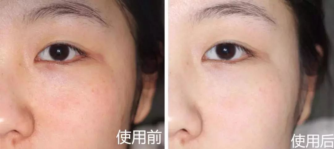 新西兰好用的精华液,新西兰最好用的精华液