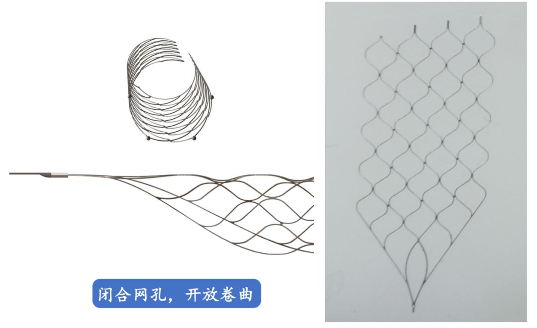 Reco特约·第10期｜国产组合助力取栓“一把通”——Ewata球囊导引导管联合Reco支架取栓分享
