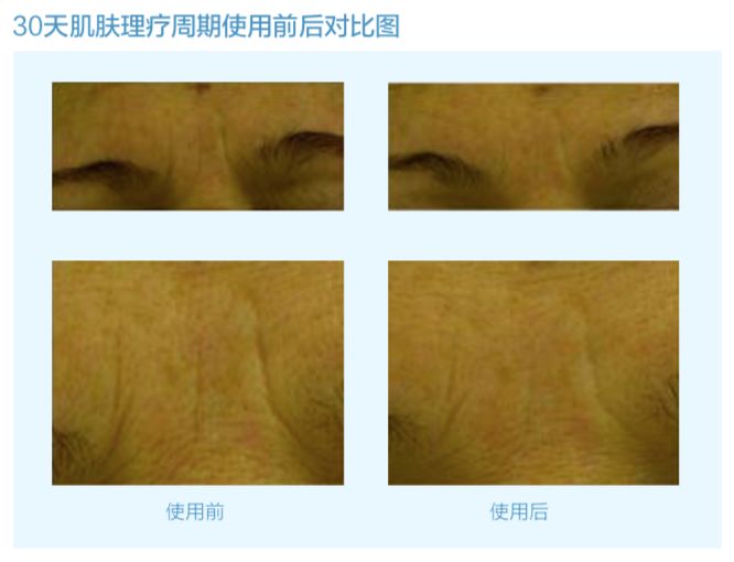 vishya玻尿酸德国价格,德国balea玻尿酸原液使用方法