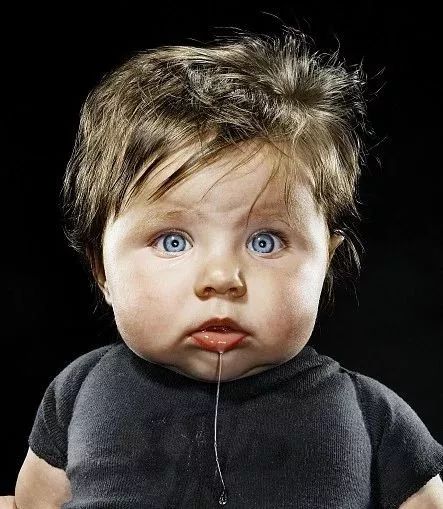 一掌拍在了图钉上，该怎么办|周末涨知识