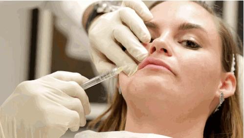 丰唇怎样让唇边更立体,适合丰唇的唇形