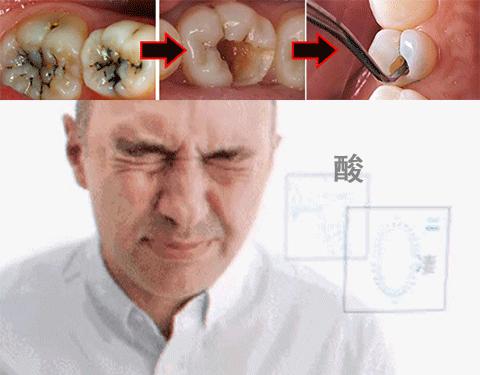 牙龈肿了出血口臭牙黄用什么牙膏,牙龈上火牙膏