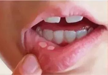 可以变白的维c推荐,维c既美白又抗老