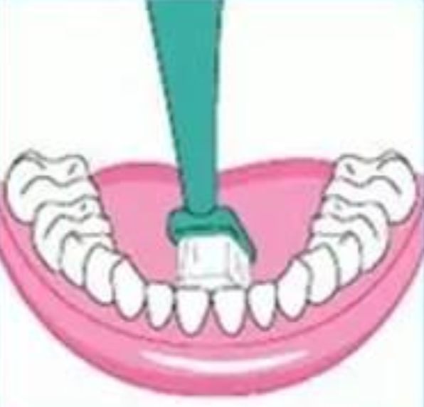 为什么下门牙突,特别爱长牙石是怎么回事