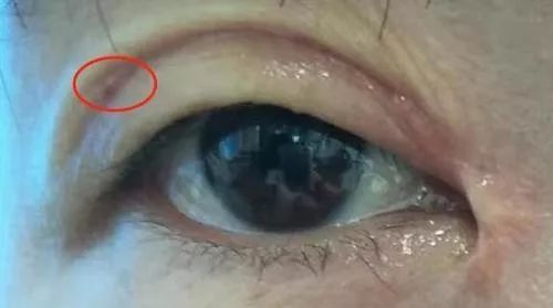 女子整容失败后欲哭无泪,女子整容整到脸上神经错乱