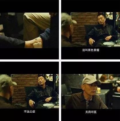 脚后跟黑痣癌变概率大吗,男子脚底长黑痣