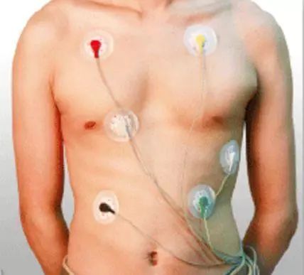 icu病房怎么监护,icu床边ct有影响吗