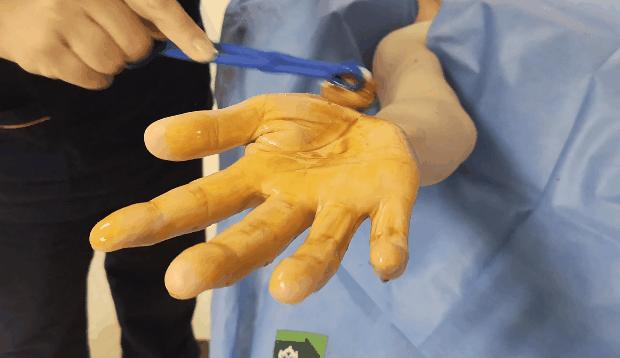 心脏造影和支架一起做大概多少钱,心脏造影支架视频全过程