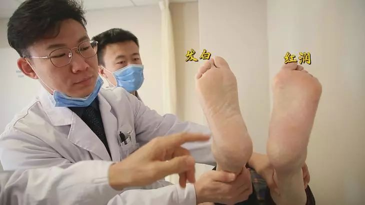 腿疼脚麻走不动可能是血管堵了,腿疼是血管不通畅造成的吗