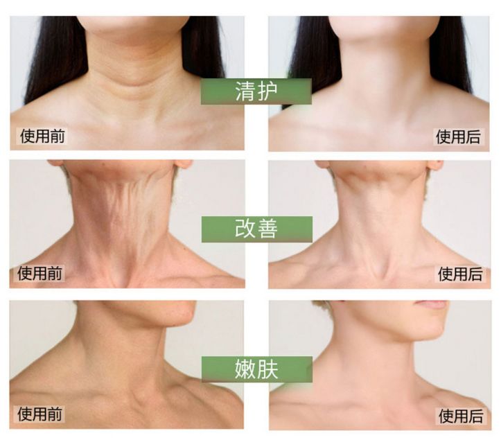 这款急救弹性蛋白贴，每天一片赶走干纹，还你天鹅美颈