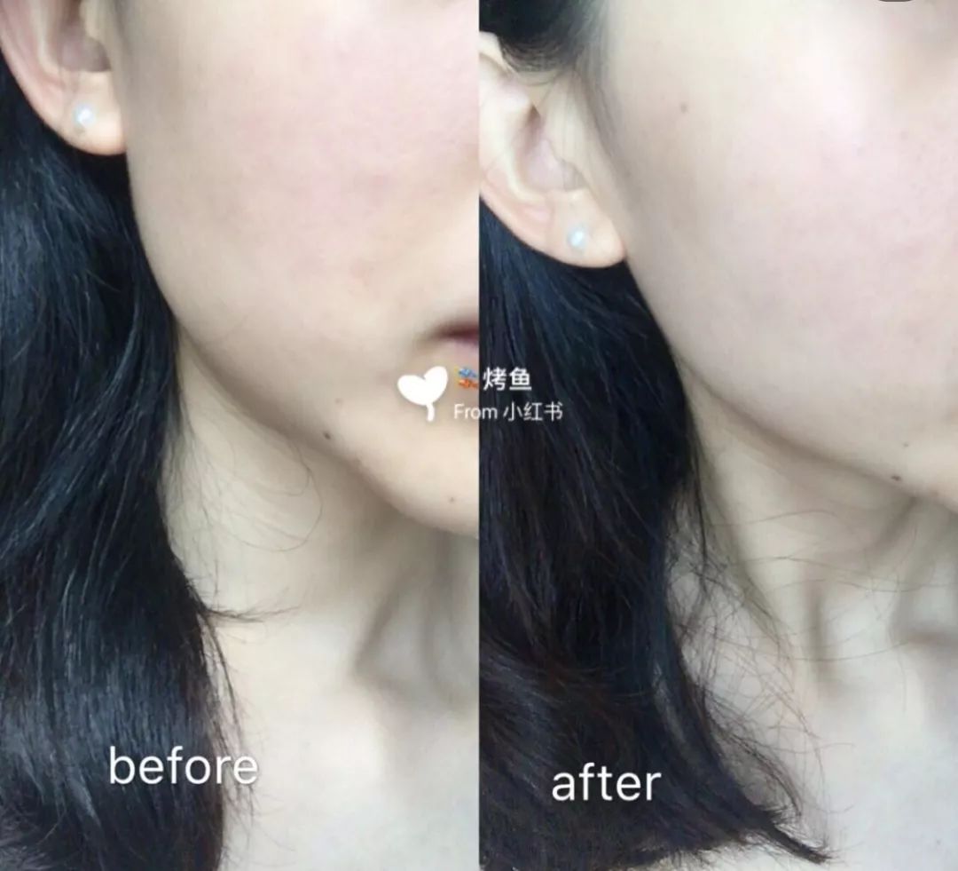 神奇的修护面霜,7ml高效急救面霜