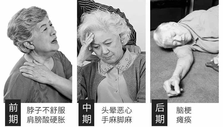 富贵包导致脖子筋痛用什么治疗,富贵包消除的最佳神器