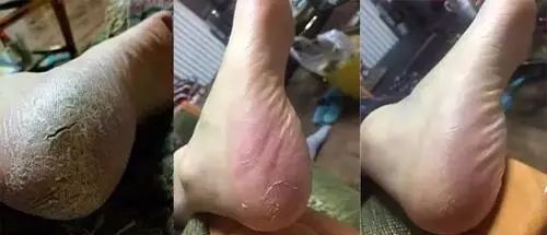 日本人吃饭都不穿鞋，熏死人了！这双耗时3年的黑科技银离子袜，美白润肤自发热，穿7天都不臭脚