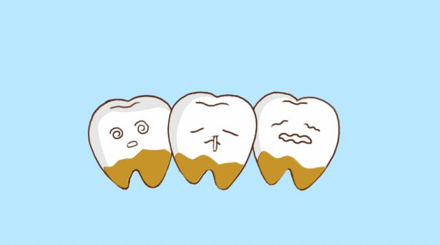 口腔粘膜炎能用含氟牙膏 (成人氟斑牙患者该不该用含氟牙膏)