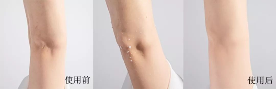 去黑头角质平价水乳,去黑头日本洗面奶