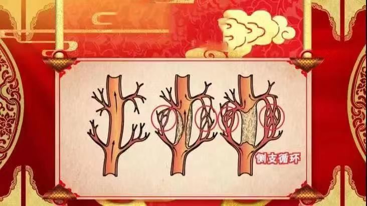 出现这4个征兆可能是血管堵住了,三根血管严重堵塞危险吗