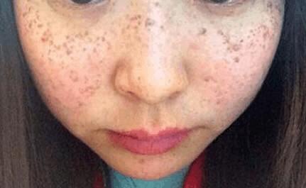 用它泡脚能赶走5种病,一个泡脚小药方赶走多种病