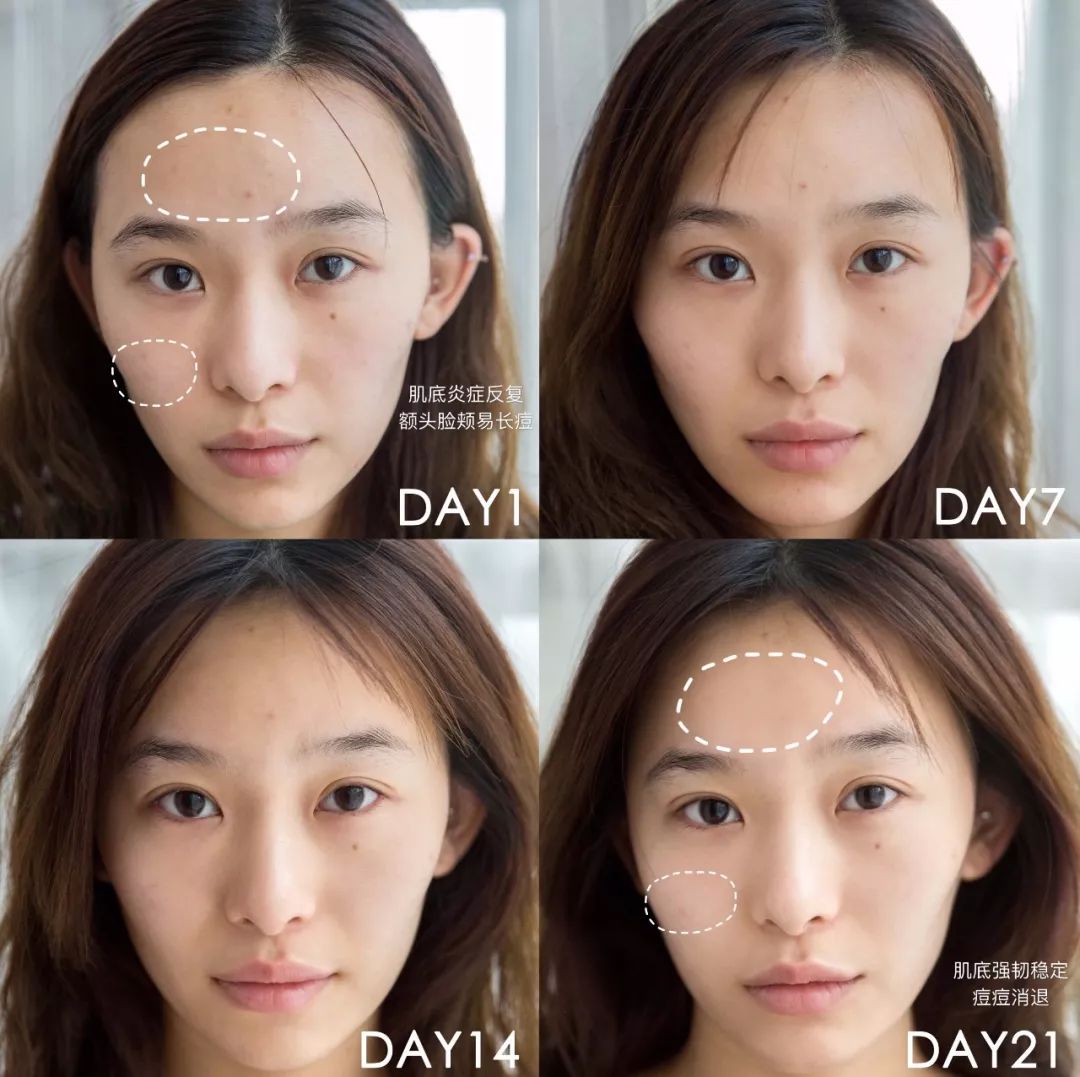 肌诊室·特别版|真人体验，医美素颜光vs明星微精华，改善皮肤哪家强？