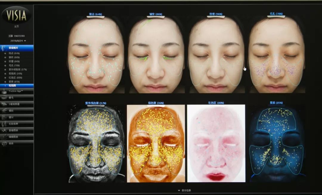 肌诊室·特别版|真人体验，医美素颜光vs明星微精华，改善皮肤哪家强？