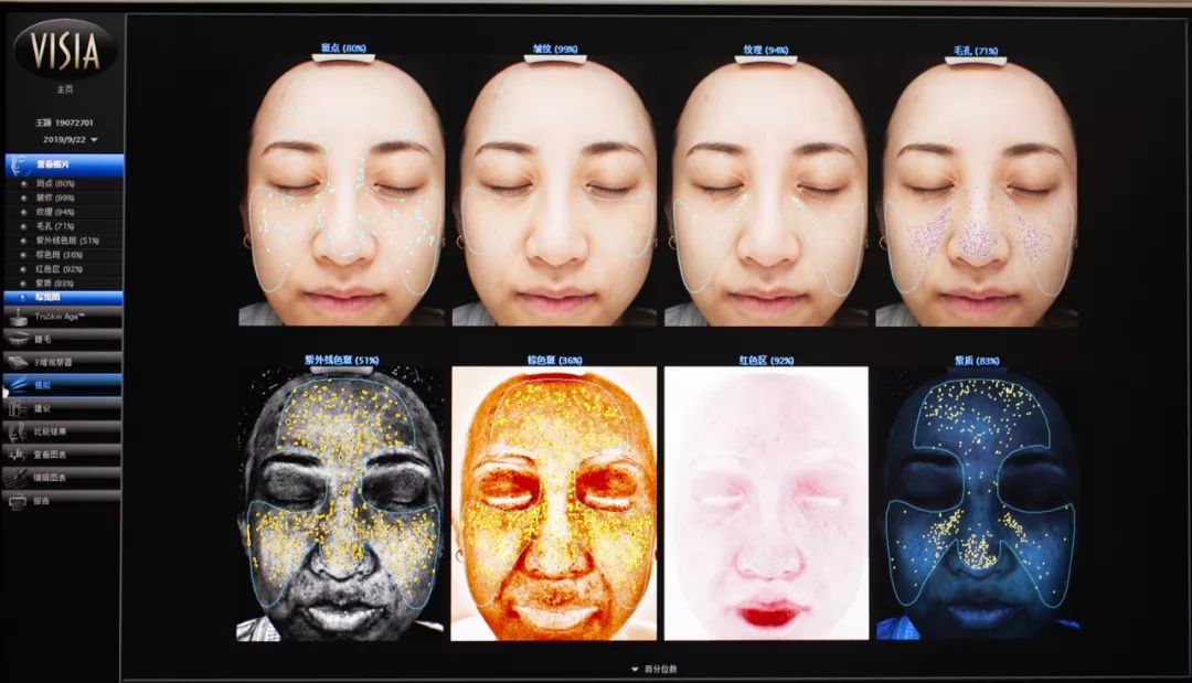 肌诊室·特别版|真人体验，医美素颜光vs明星微精华，改善皮肤哪家强？