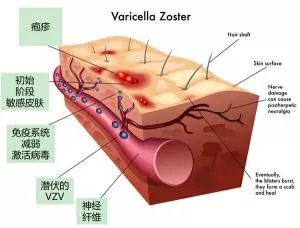共享大医生|每周集锦：阿司匹林能延缓脑萎缩，防治老年痴呆？大医生说脑萎缩需要评估