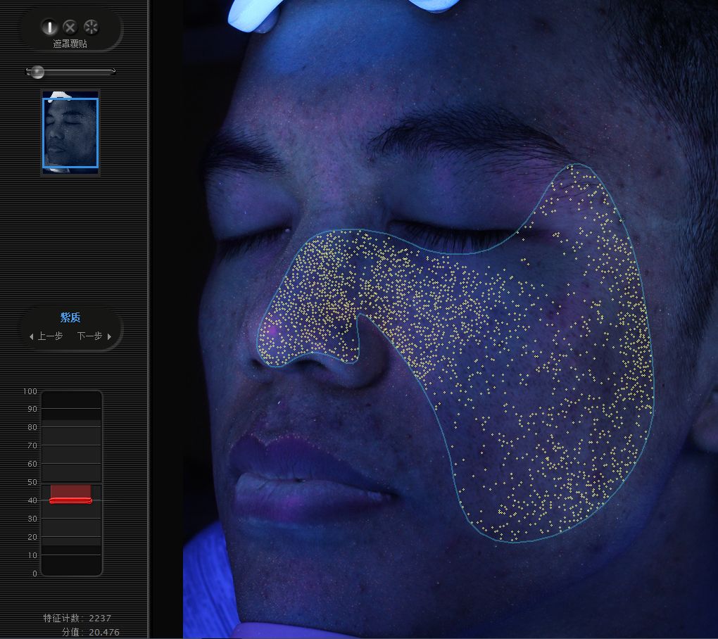 五周年福利｜皮肤“照妖镜”VISIA免费体验！定制你的皮肤管理方案，浙大四院五周年福利持续放送中