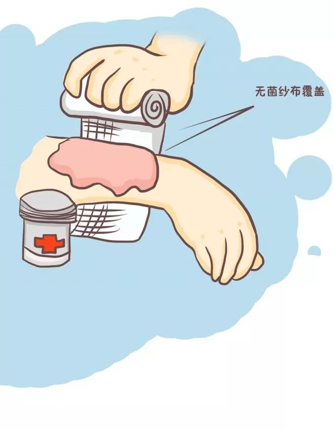 真相揭秘｜蛋清能治疗烫伤吗？