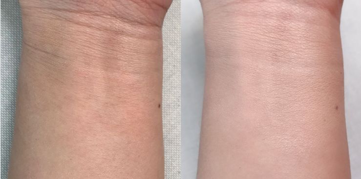 植村秀遮瑕笔测评,植村秀隔离遮瑕ysl