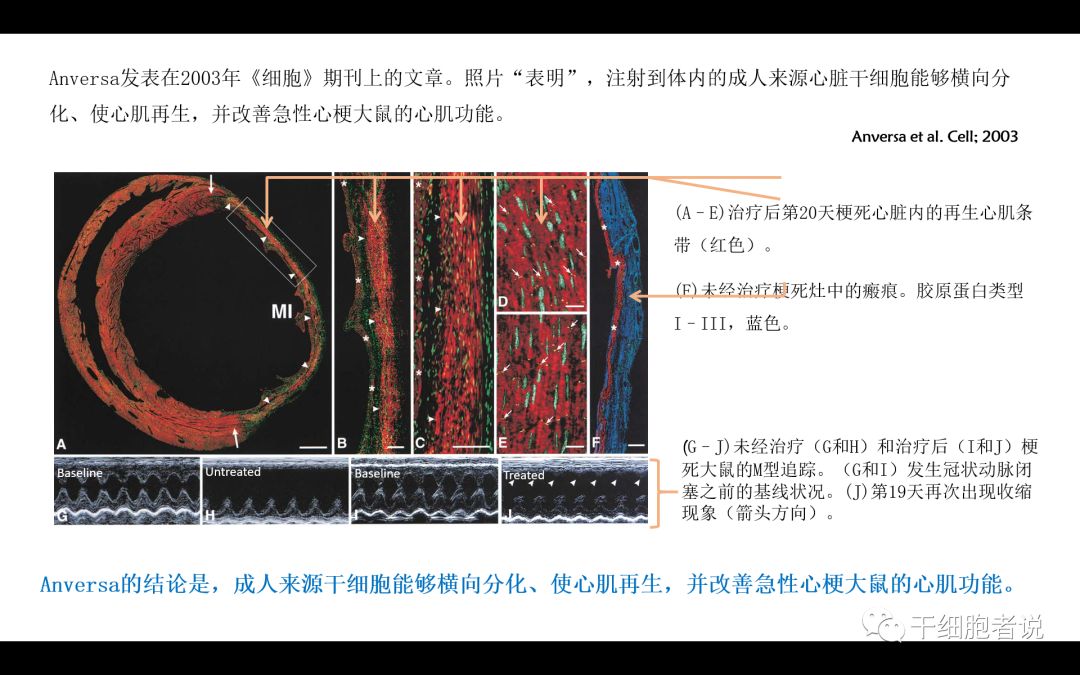 干货：干细胞治疗心血管疾病的未来（PPT）