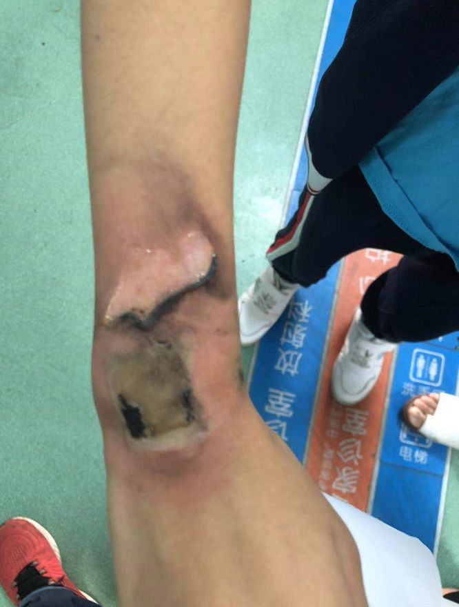 紧急提醒你家孩子天天用的东西,紧急提醒孩子天天戴什么