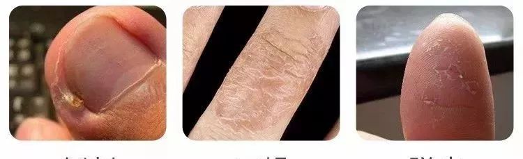 不要让你暴露你的年龄,别让皮肤暴露了你的年龄