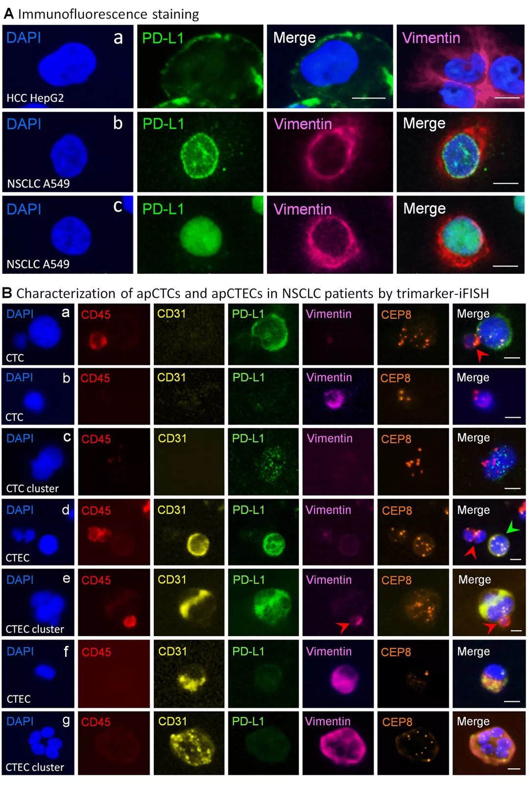 新视角pdd名单,scc在肺癌诊断中的价值