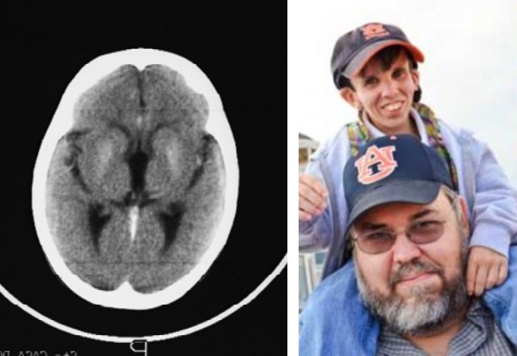 神经影像,神经影像解剖图